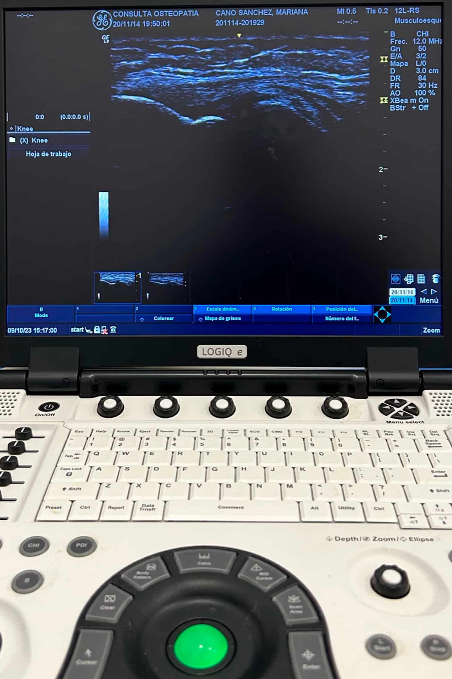 Pantalla ecógrafo